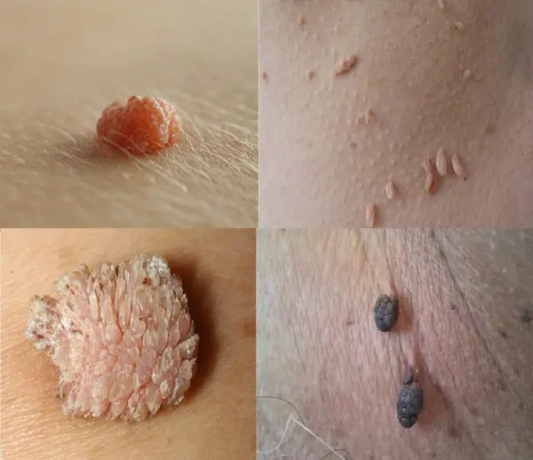 Эффект применения Чёрного лекаря