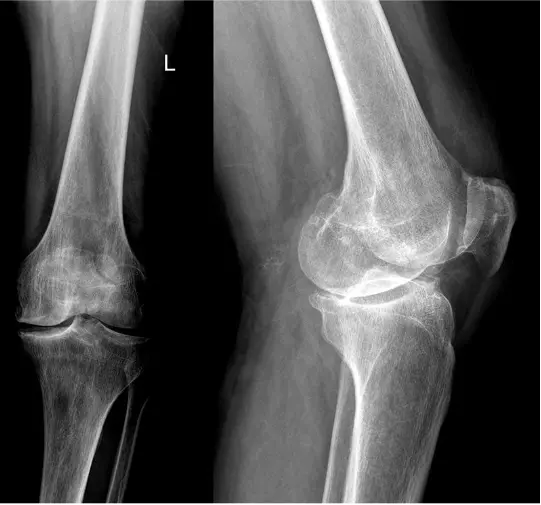 герой интервью здоров