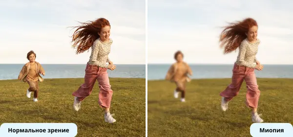 Схема глаза